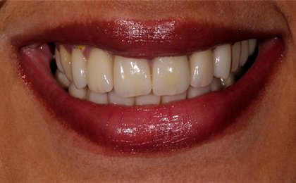 Tiny Pearls Dental Care - Post - Operative
