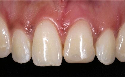 Tiny Pearls Dental Care - Pre - Operative