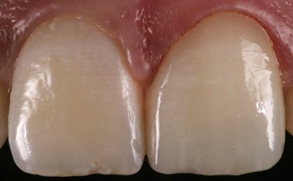 Tiny Pearls Dental Care - Post - Operative