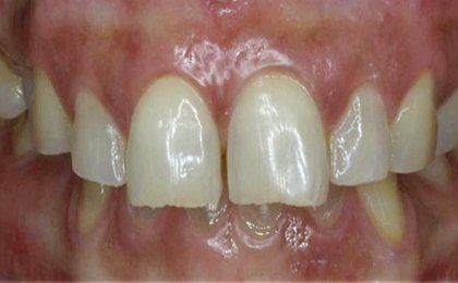 Tiny Pearls Dental Care - Pre - Operative