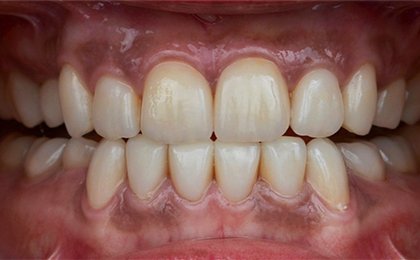 Tiny Pearls Dental Care - Post - Operative